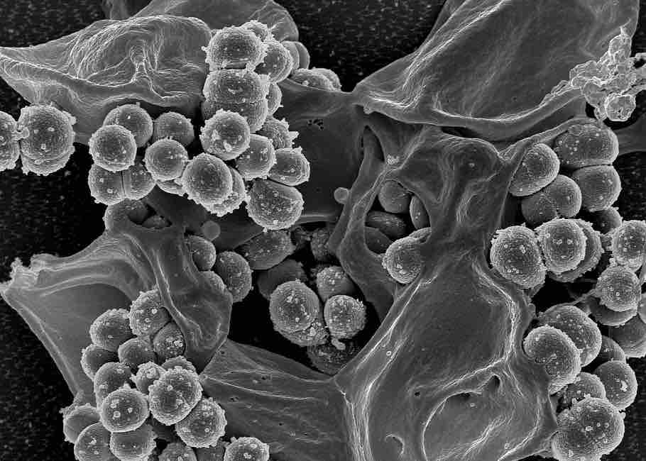Nuovo ceppo batterico per regolare flora intestinale umana